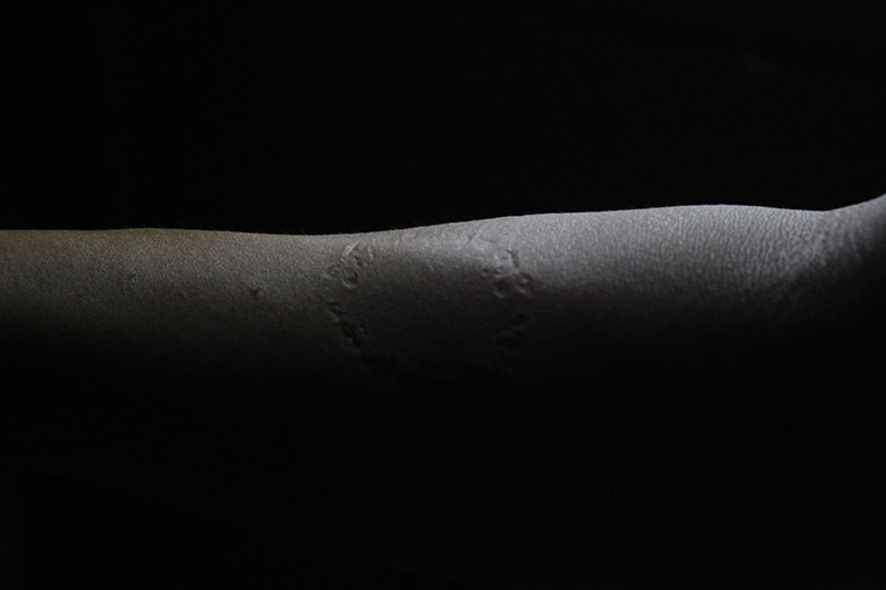 CURRENT AFFAIRS: Pressure Points